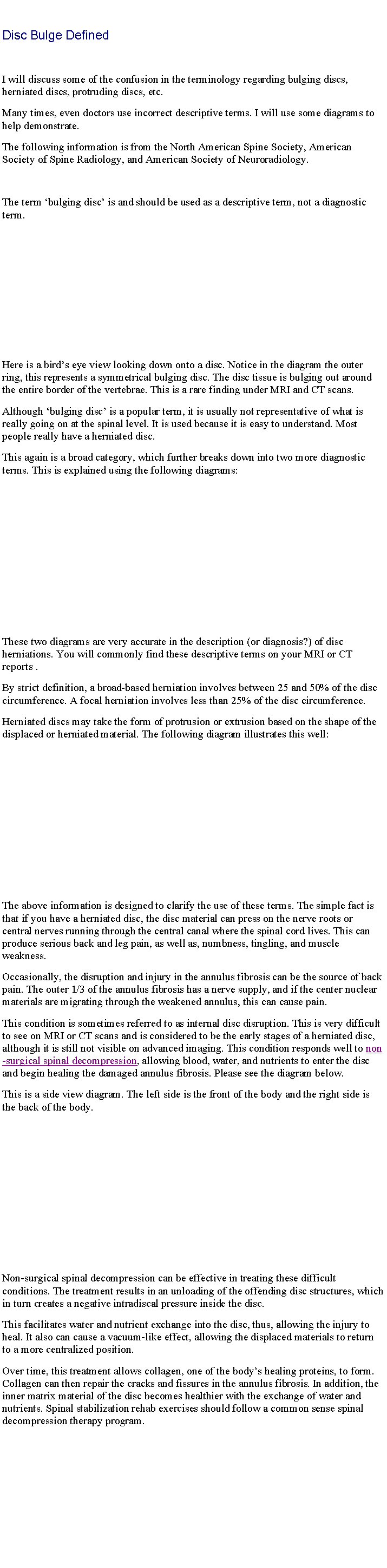 Text Box: Disc Bulge DefinedI will discuss some of the confusion in the terminology regarding bulging discs, herniated discs, protruding discs, etc. Many times, even doctors use incorrect descriptive terms. I will use some diagrams to help demonstrate.The following information is from the North American Spine Society, American Society of Spine Radiology, and American Society of Neuroradiology.The term bulging disc is and should be used as a descriptive term, not a diagnostic term.Here is a birds eye view looking down onto a disc. Notice in the diagram the outer ring, this represents a symmetrical bulging disc. The disc tissue is bulging out around the entire border of the vertebrae. This is a rare finding under MRI and CT scans.Although bulging disc is a popular term, it is usually not representative of what is really going on at the spinal level. It is used because it is easy to understand. Most people really have a herniated disc.This again is a broad category, which further breaks down into two more diagnostic terms. This is explained using the following diagrams:These two diagrams are very accurate in the description (or diagnosis?) of disc herniations. You will commonly find these descriptive terms on your MRI or CT reports .By strict definition, a broad-based herniation involves between 25 and 50% of the disc circumference. A focal herniation involves less than 25% of the disc circumference.Herniated discs may take the form of protrusion or extrusion based on the shape of the displaced or herniated material. The following diagram illustrates this well:The above information is designed to clarify the use of these terms. The simple fact is that if you have a herniated disc, the disc material can press on the nerve roots or central nerves running through the central canal where the spinal cord lives. This can produce serious back and leg pain, as well as, numbness, tingling, and muscle weakness.Occasionally, the disruption and injury in the annulus fibrosis can be the source of back pain. The outer 1/3 of the annulus fibrosis has a nerve supply, and if the center nuclear materials are migrating through the weakened annulus, this can cause pain.This condition is sometimes referred to as internal disc disruption. This is very difficult to see on MRI or CT scans and is considered to be the early stages of a herniated disc, although it is still not visible on advanced imaging. This condition responds well to non-surgical spinal decompression, allowing blood, water, and nutrients to enter the disc and begin healing the damaged annulus fibrosis. Please see the diagram below.This is a side view diagram. The left side is the front of the body and the right side is the back of the body.Non-surgical spinal decompression can be effective in treating these difficult conditions. The treatment results in an unloading of the offending disc structures, which in turn creates a negative intradiscal pressure inside the disc.This facilitates water and nutrient exchange into the disc, thus, allowing the injury to heal. It also can cause a vacuum-like effect, allowing the displaced materials to return to a more centralized position.Over time, this treatment allows collagen, one of the bodys healing proteins, to form. Collagen can then repair the cracks and fissures in the annulus fibrosis. In addition, the inner matrix material of the disc becomes healthier with the exchange of water and nutrients. Spinal stabilization rehab exercises should follow a common sense spinal decompression therapy program. 